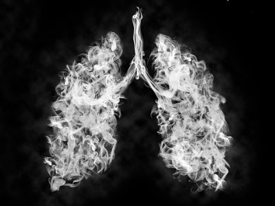 illustration-of-a-toxic-smoke-in-lung-cancer-or-illness-concept-picture-id1179207088